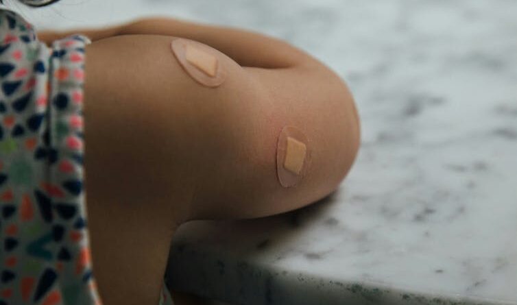 A child's upper arm with two circular bands.